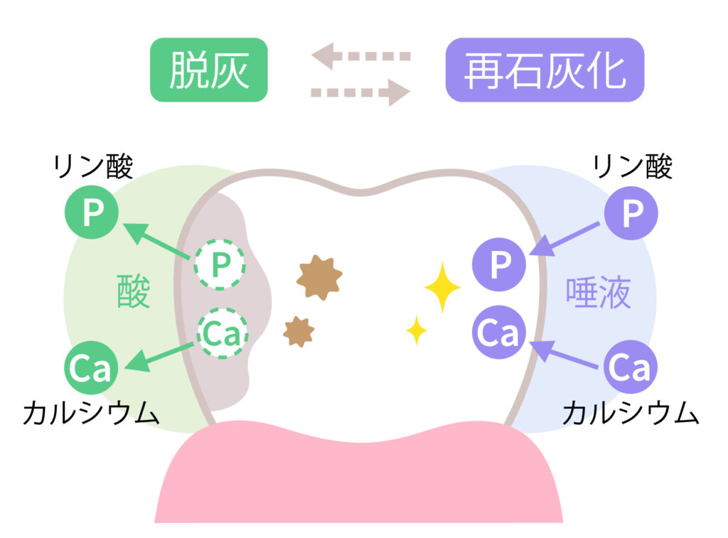 脱灰と再石灰化