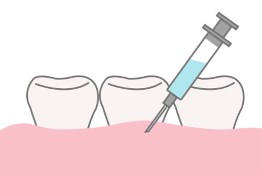 浸透麻酔のイメージ