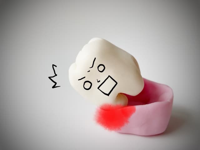 歯を失ったイメージ