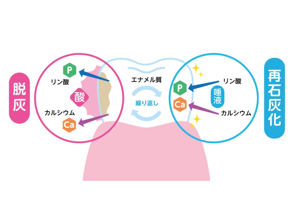脱灰のイメージ